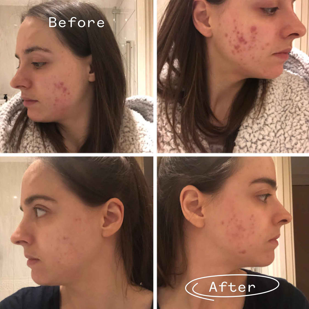 Instant Kalmer™ Serum