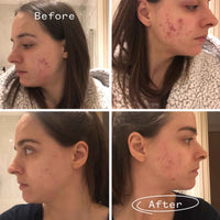 Instant Kalmer™ Serum