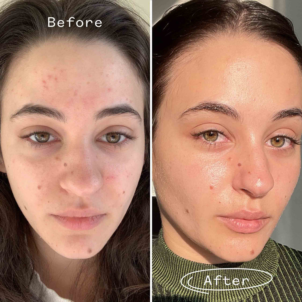 Carbon Star™ Face Oil