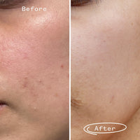 Tri-Mushroom 10% Super-Soothing Booster