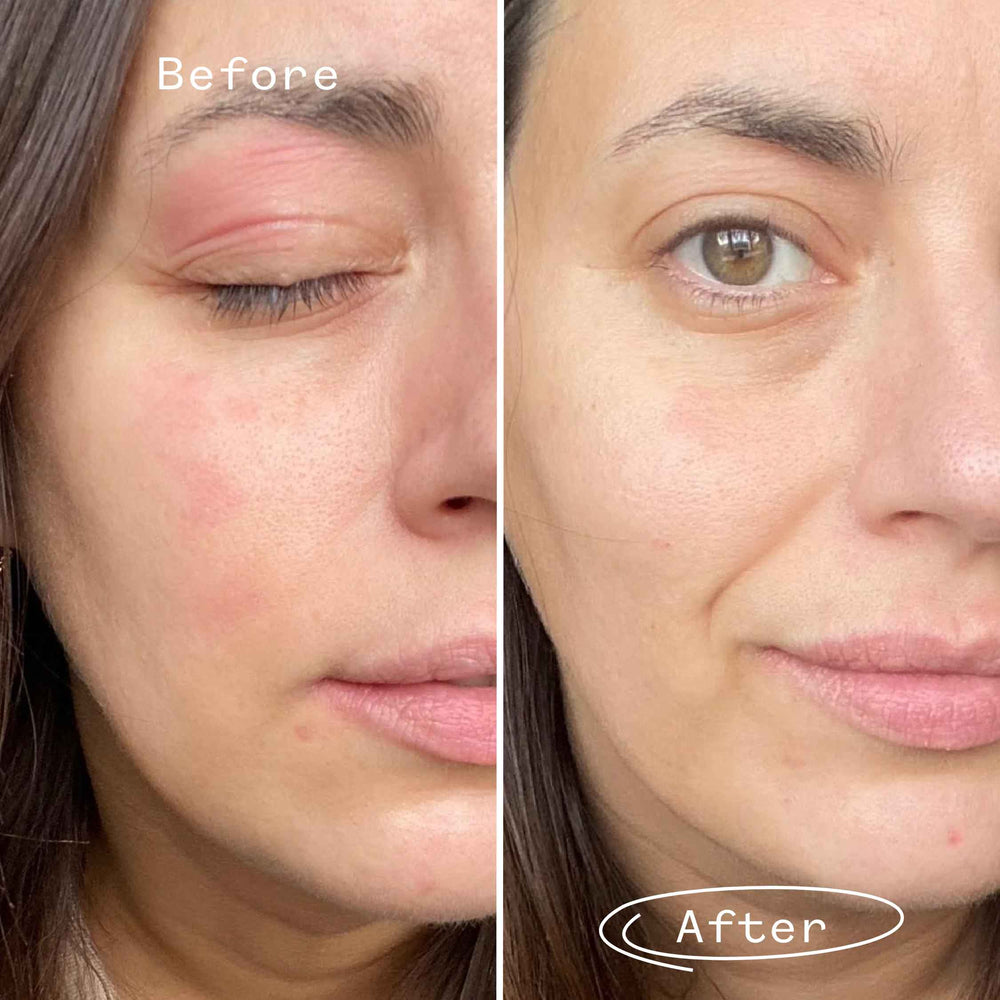 Pai Skincare Feather Canyon eye cream before & after