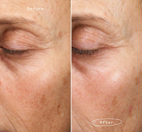 Fade Forward™ Serum