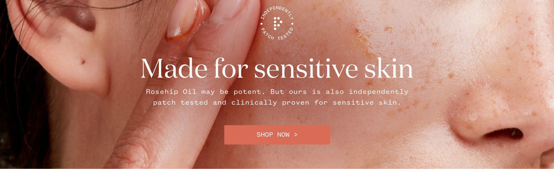 Rosehip: the wonder ingredient