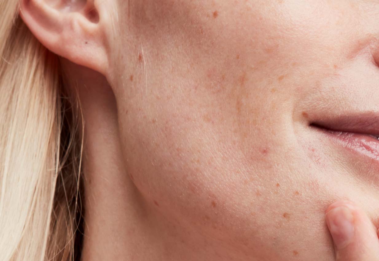   skin barrier close up