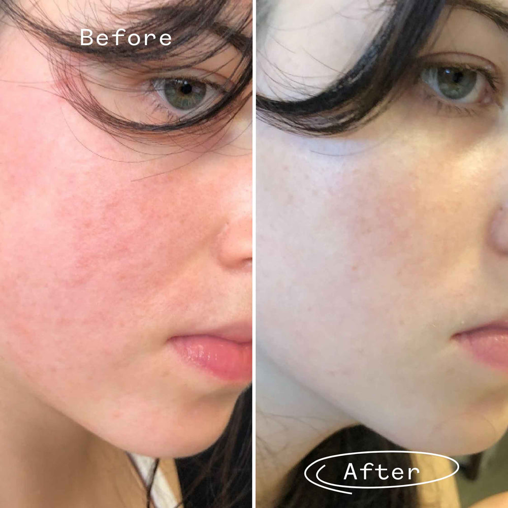 The Light Fantastic™ Face Oil Mini